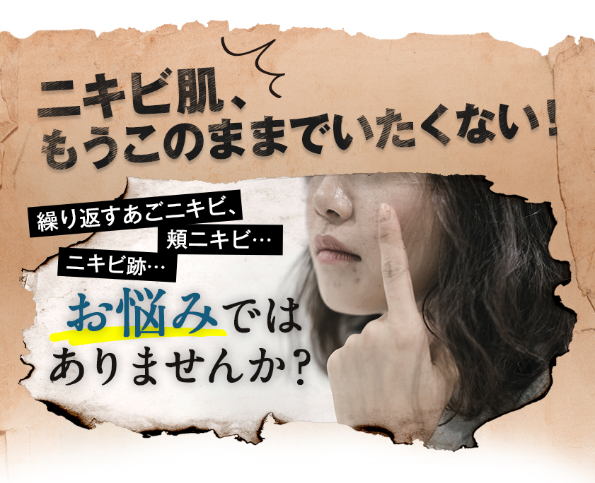 明日の肌を輝かせる Asuhada 目指すはニキビ知らずのno 1素肌